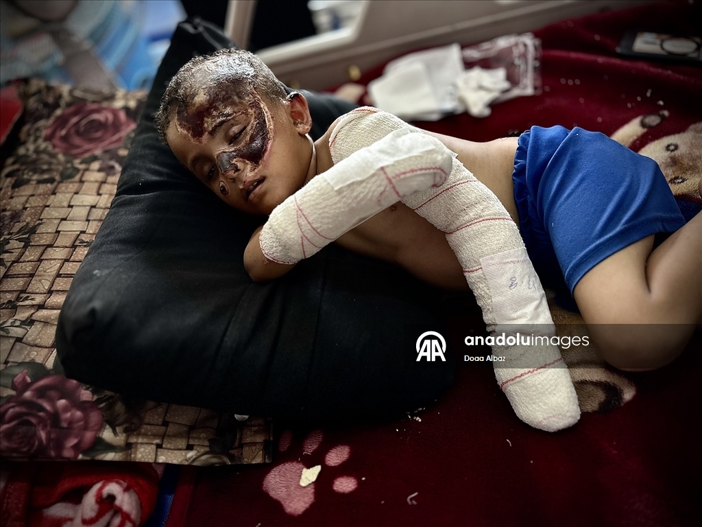 İsrail saldırısında öksüz kalan Gazzeli çocuk, aldığı yaralarla yaşam mücadelesi veriyor