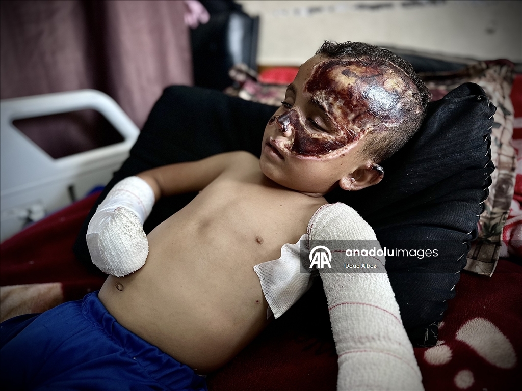 İsrail saldırısında öksüz kalan Gazzeli çocuk, aldığı yaralarla yaşam mücadelesi veriyor