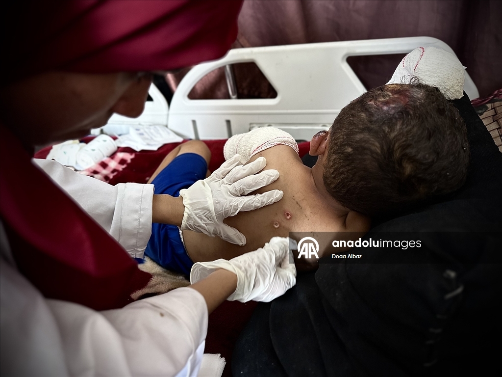 İsrail saldırısında öksüz kalan Gazzeli çocuk, aldığı yaralarla yaşam mücadelesi veriyor