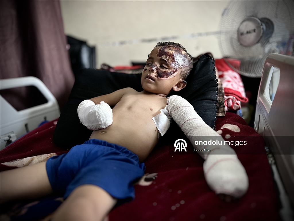 İsrail saldırısında öksüz kalan Gazzeli çocuk, aldığı yaralarla yaşam mücadelesi veriyor