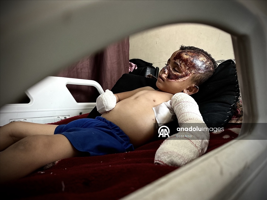 İsrail saldırısında öksüz kalan Gazzeli çocuk, aldığı yaralarla yaşam mücadelesi veriyor
