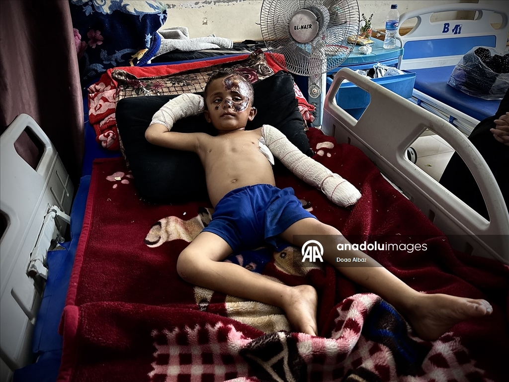 İsrail saldırısında öksüz kalan Gazzeli çocuk, aldığı yaralarla yaşam mücadelesi veriyor