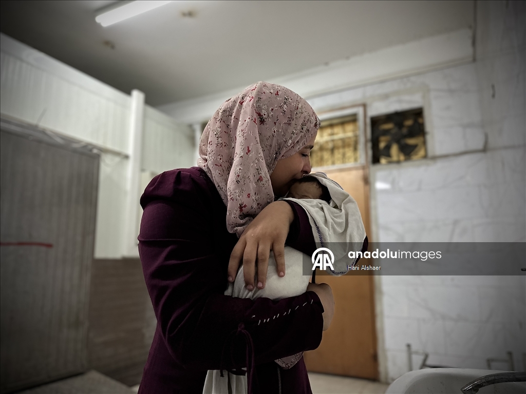 Gazze'de yetersiz beslenme nedeniyle 2 aylık bebek hayatını kaybetti