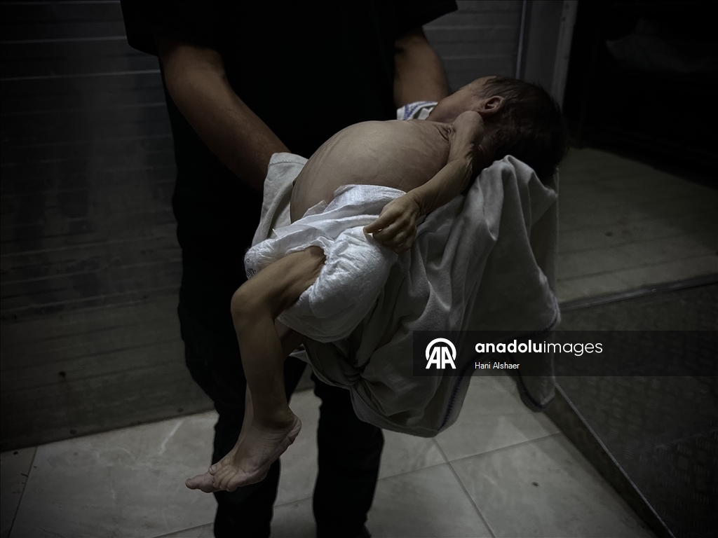 Gazze'de yetersiz beslenme nedeniyle 2 aylık bebek hayatını kaybetti