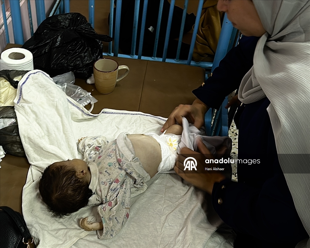 Gazze'de yetersiz beslenme nedeniyle 2 aylık bebek hayatını kaybetti