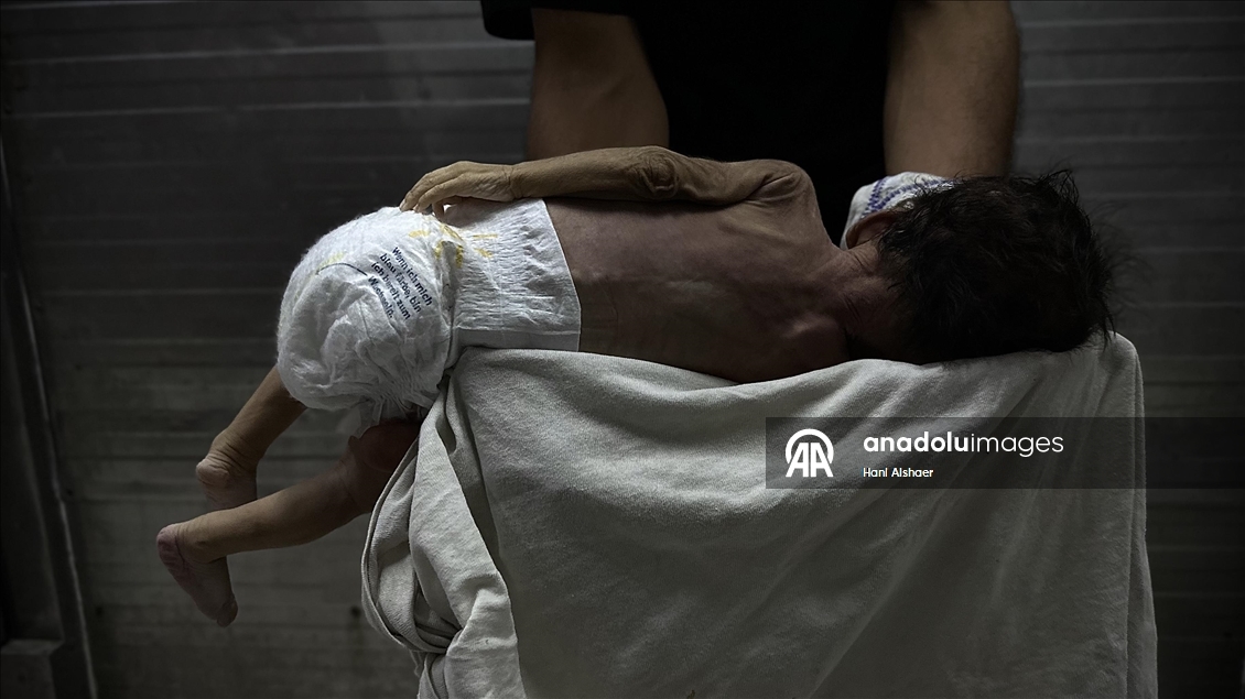 Gazze'de yetersiz beslenme nedeniyle 2 aylık bebek hayatını kaybetti