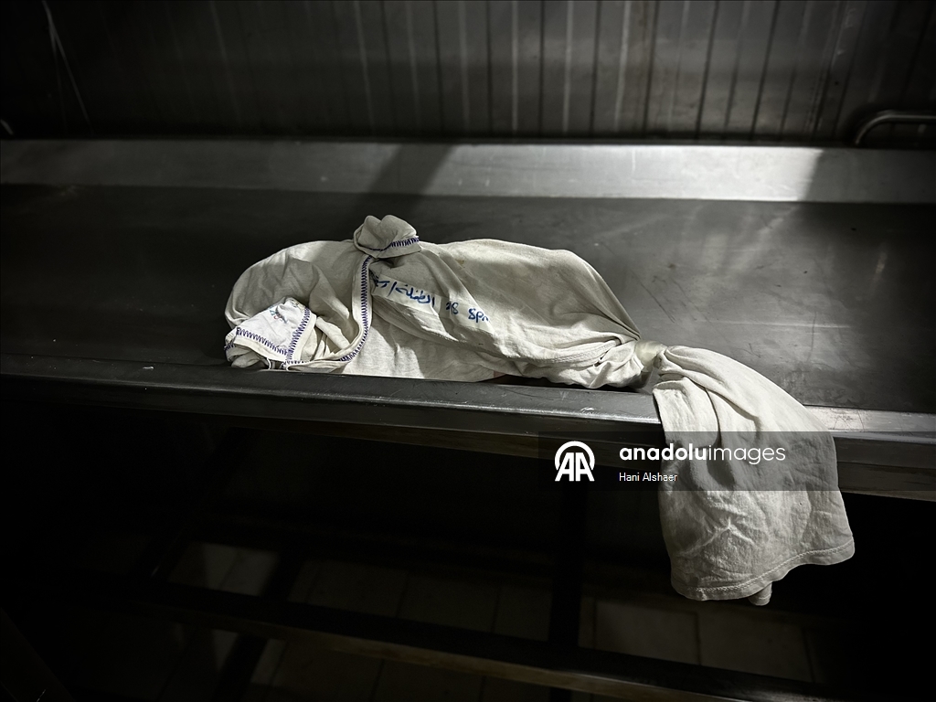 Gazze'de yetersiz beslenme nedeniyle 2 aylık bebek hayatını kaybetti