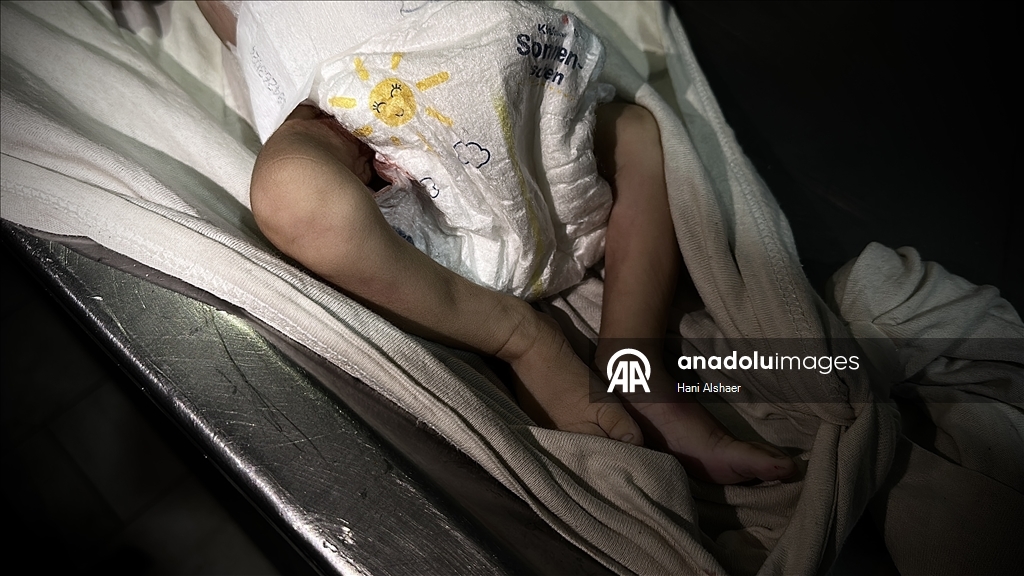 Gazze'de yetersiz beslenme nedeniyle 2 aylık bebek hayatını kaybetti