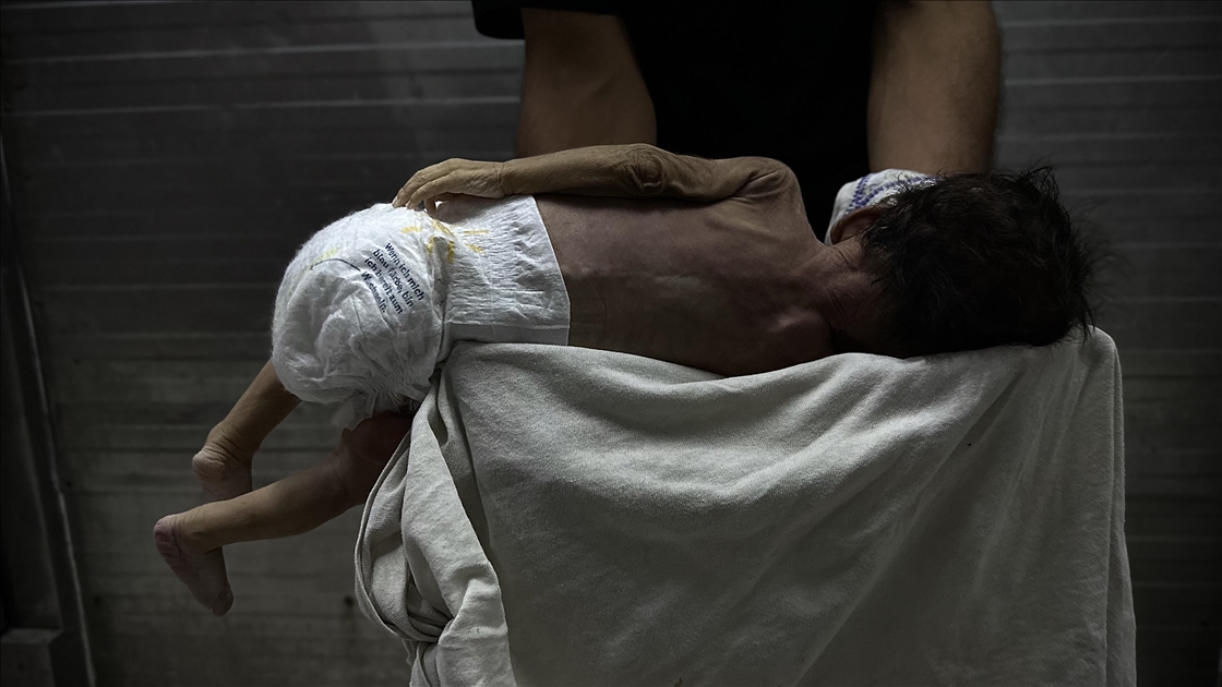 Gazze'de yetersiz beslenme nedeniyle 2 aylık bebek hayatını kaybetti