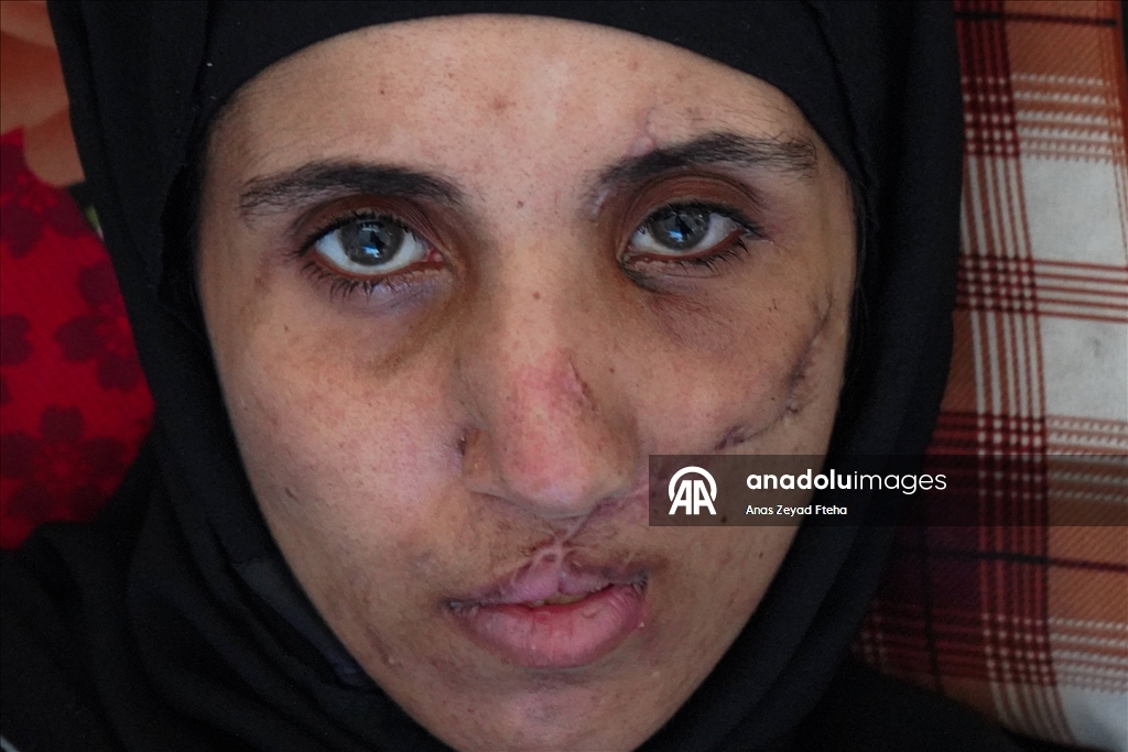 Gazze’de saldırıların hedefi olan Kahil ailesi zor koşullarda yaşam mücadelesinde