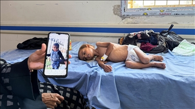 Gazze'deki Rantisi Hastanesi'nde yetersiz beslenme vakaları en yüksek seviyelerine ulaştı