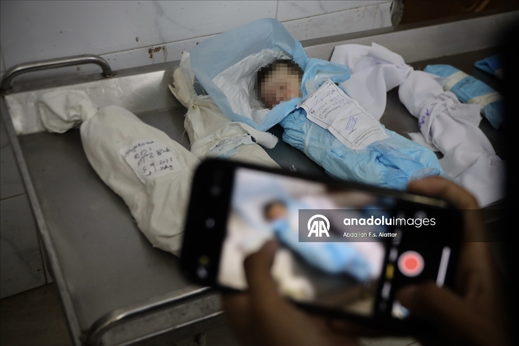 Gazze’de Nasır Hastanesi’nde bir haftada 7 çocuk daha yaşamını yitirdi
