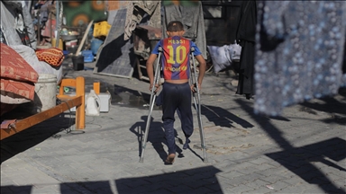 Gazze’de bir bacağını kaybeden 9 yaşındaki Ratib’in protez umudu