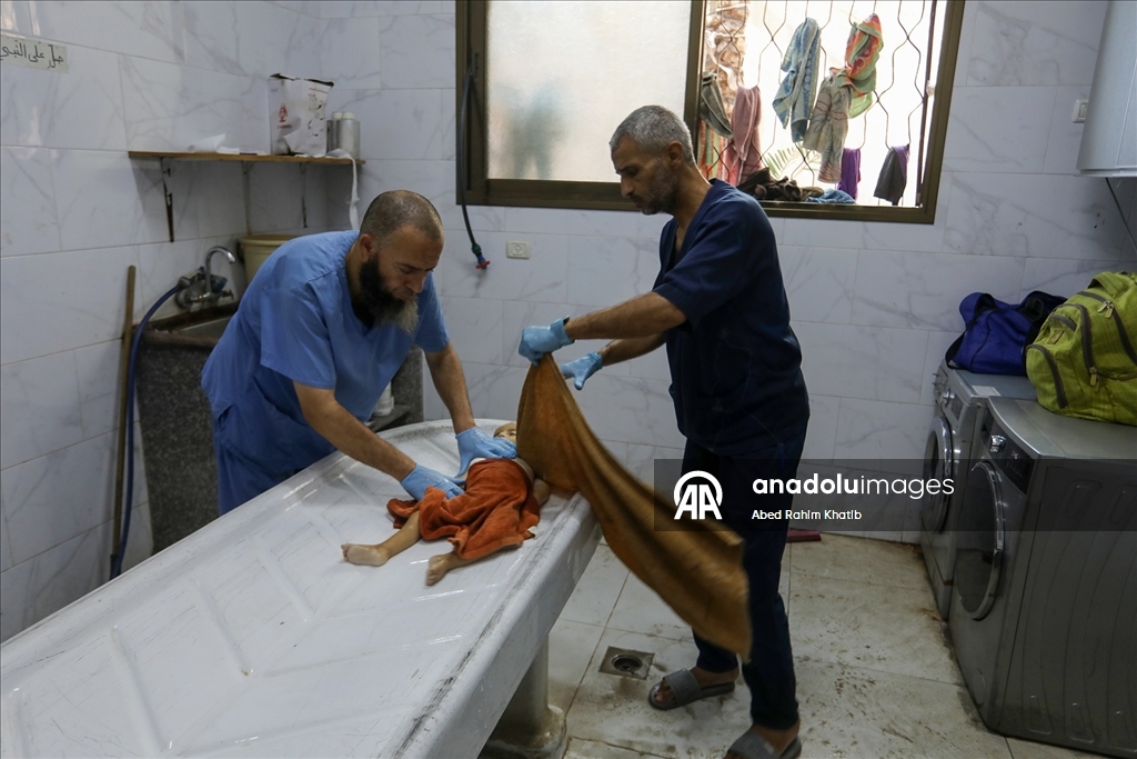 Gazze’de tedaviye erişemeyen 8 aylık Saeed al-Şahrit hayatını kaybetti