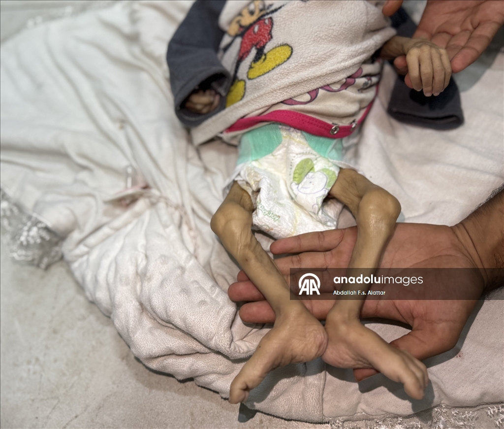 Cumhurbaşkanı Erdoğan, İsrail'in Gazze'deki soykırımını AA'nın fotoğraflarıyla dünyaya anlattı