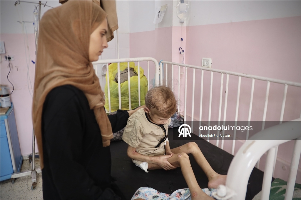 الطفلة مي.. "وردة" أذوى التجويع الإسرائيلي جسدها بغزة