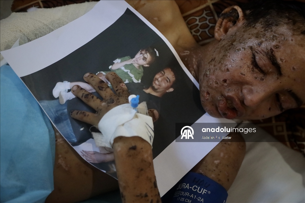  İsrail, 10 yaşındaki Gazzeli çocuk Muhammed'i yetim ve öksüz bıraktı