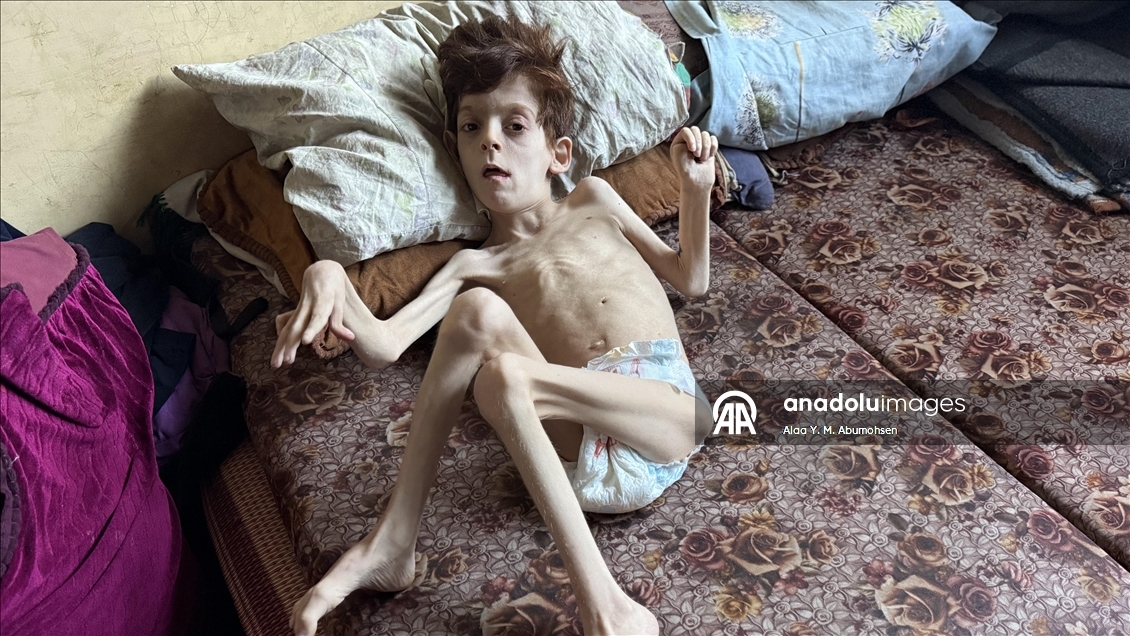 İsrail'in Gazze Şeridi'nde yaptığı soykırımın 2. yılında Filistinlilerin açlıkla mücadelesi sürüyor