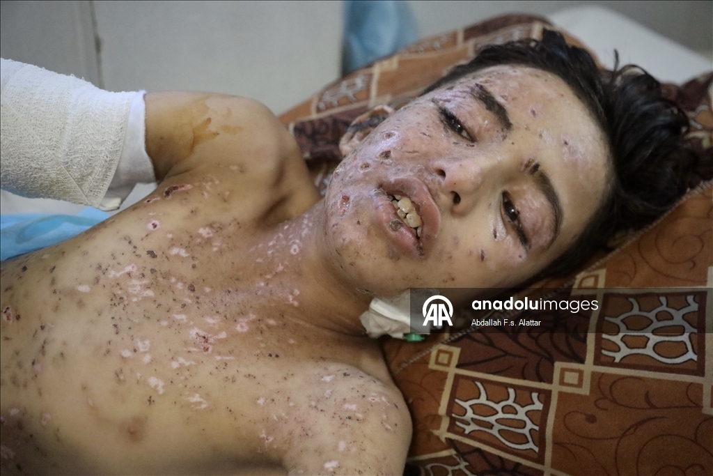 İsrail, 10 yaşındaki Gazzeli çocuk Muhammed'i yetim ve öksüz bıraktı