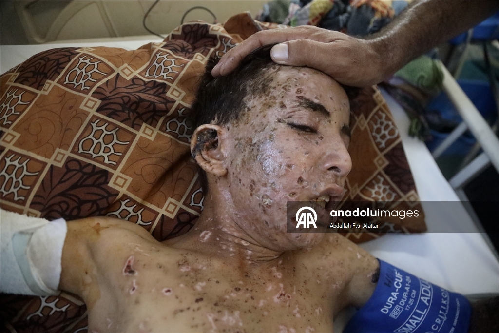  İsrail, 10 yaşındaki Gazzeli çocuk Muhammed'i yetim ve öksüz bıraktı