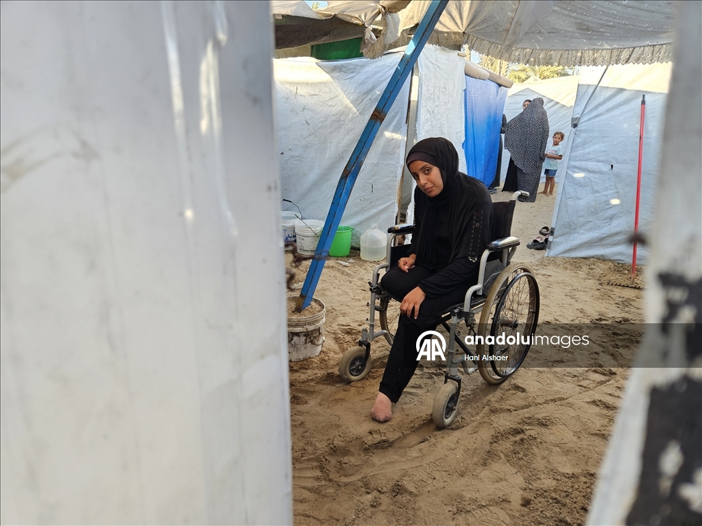 İsrail'in Gazze'ye saldırılarının 2. yılında kanser hastaları ilaç yetersizliği nedeniyle uzuvlarını kaybediyor