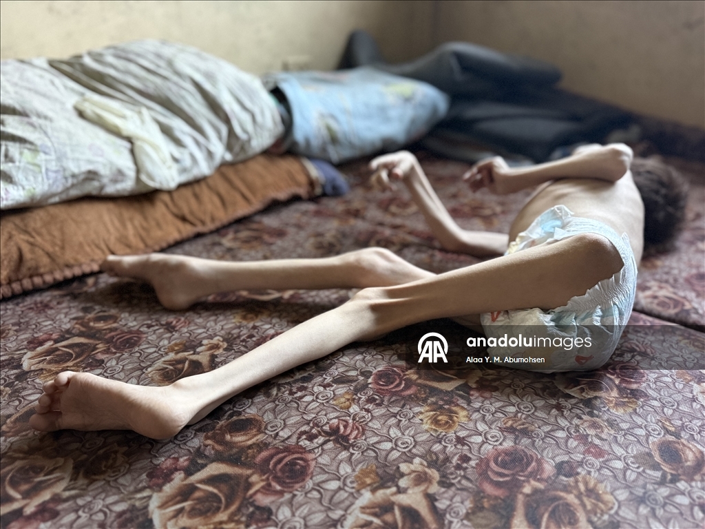İsrail'in Gazze Şeridi'nde yaptığı soykırımın 2. yılında Filistinlilerin açlıkla mücadelesi sürüyor