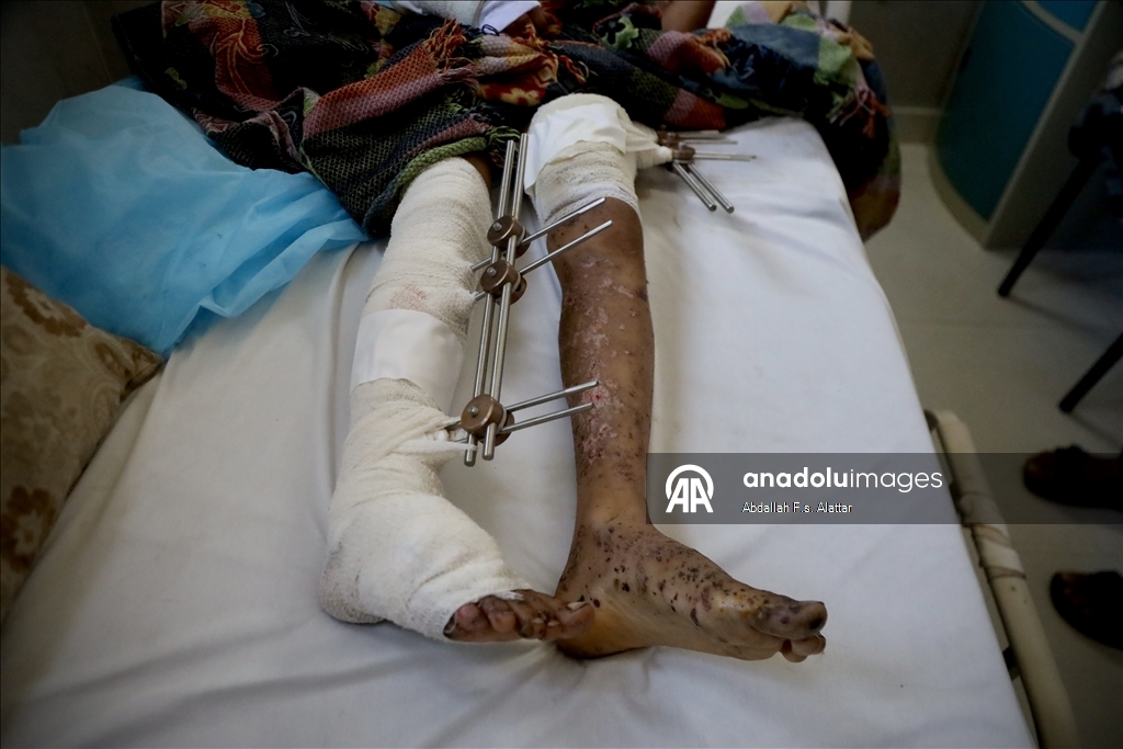  İsrail, 10 yaşındaki Gazzeli çocuk Muhammed'i yetim ve öksüz bıraktı