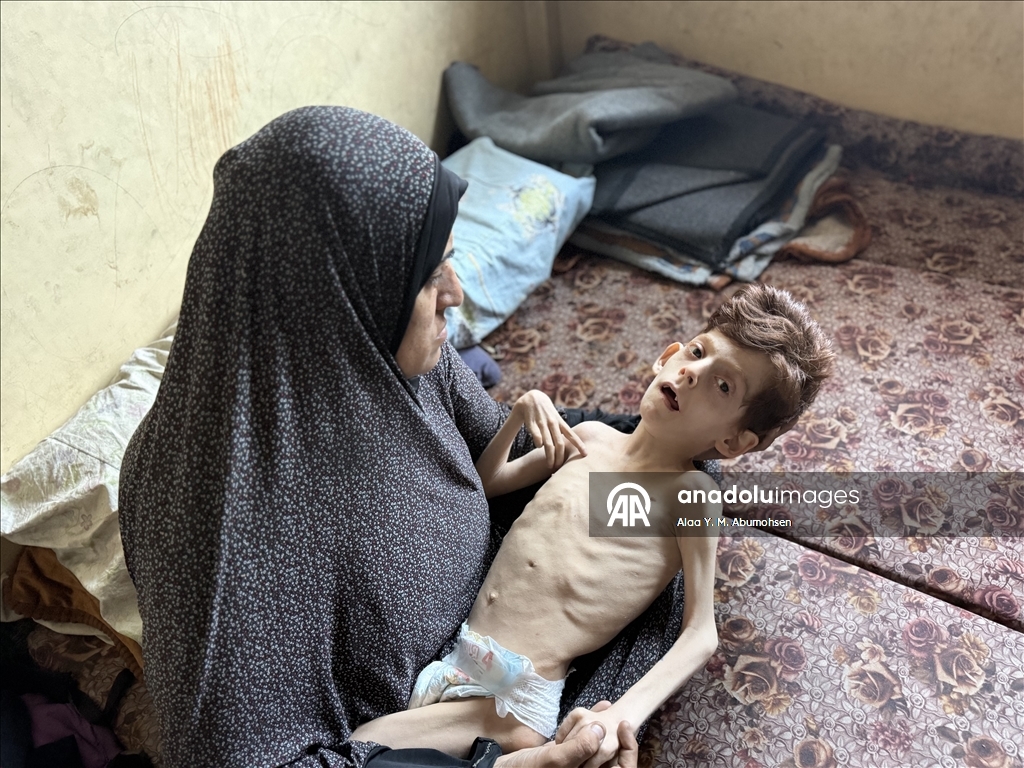 İsrail'in Gazze Şeridi'nde yaptığı soykırımın 2. yılında Filistinlilerin açlıkla mücadelesi sürüyor