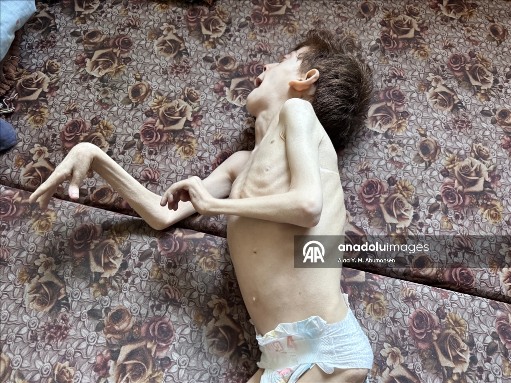 İsrail'in Gazze Şeridi'nde yaptığı soykırımın 2. yılında Filistinlilerin açlıkla mücadelesi sürüyor