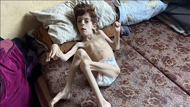 İsrail'in Gazze Şeridi'nde yaptığı soykırımın 2. yılında Filistinlilerin açlıkla mücadelesi sürüyor