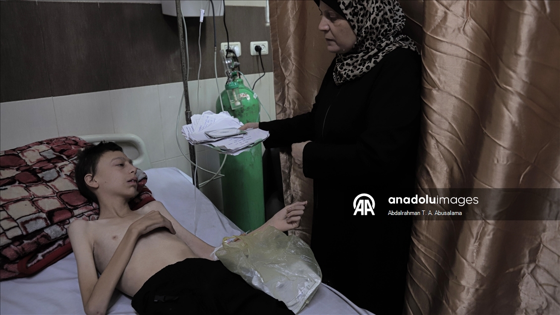 Gazzeli çocuklar, bedenlerinde İsrail soykırımının izlerini taşıyor