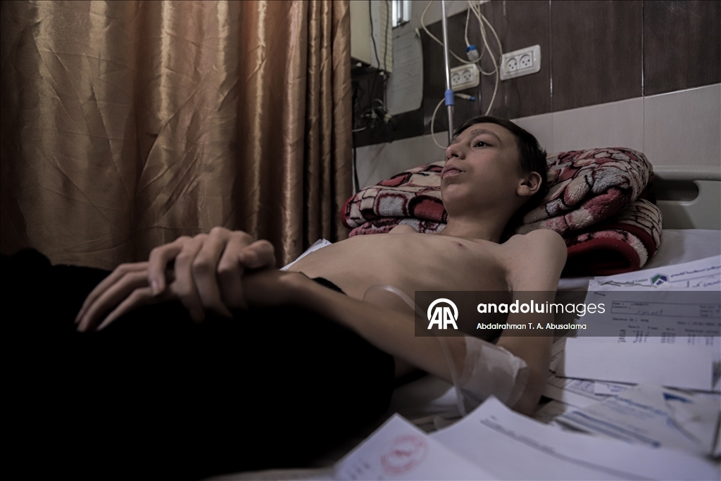 Gazzeli çocuklar, bedenlerinde İsrail soykırımının izlerini taşıyor