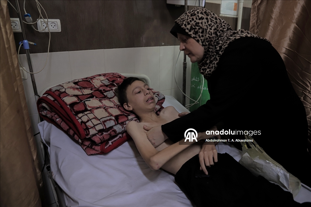 Gazzeli çocuklar, bedenlerinde İsrail soykırımının izlerini taşıyor