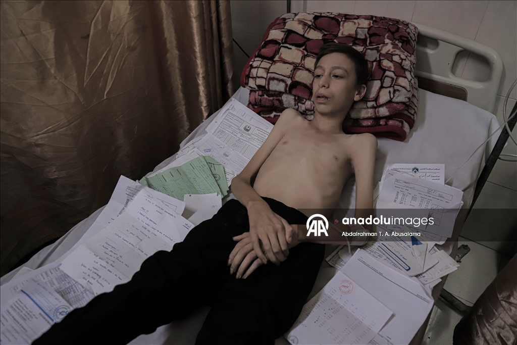 Gazzeli çocuklar, bedenlerinde İsrail soykırımının izlerini taşıyor