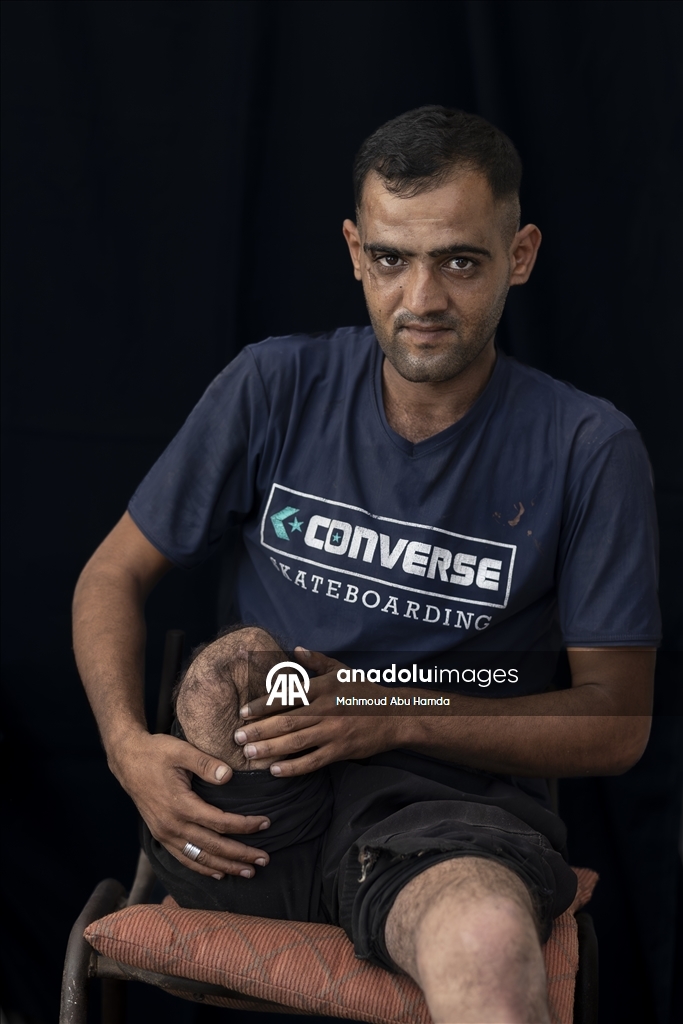 Палестинец Махмуд Саллуут, ставший инвалидом после израильских атак, борется за жизнь