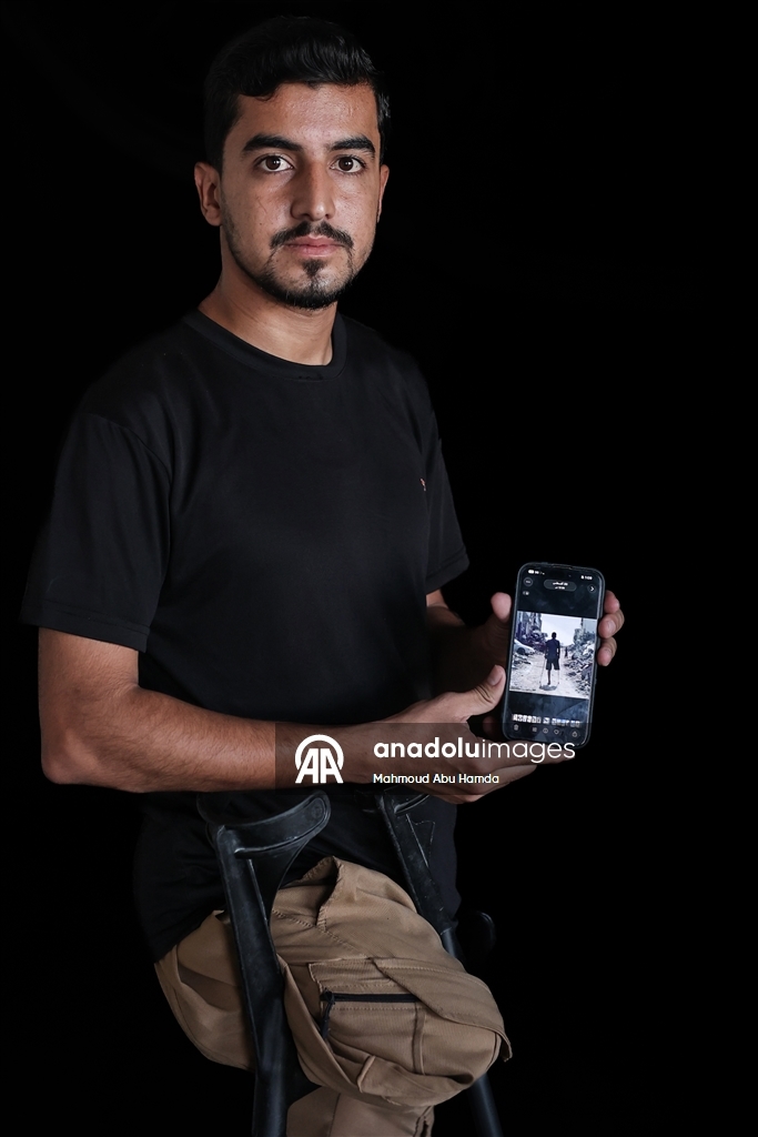 Палестинец Махмуд Саллуут, ставший инвалидом после израильских атак, борется за жизнь