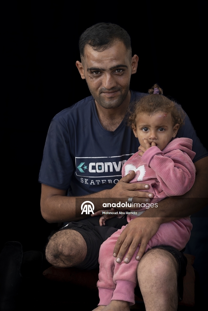 Палестинец Махмуд Саллуут, ставший инвалидом после израильских атак, борется за жизнь