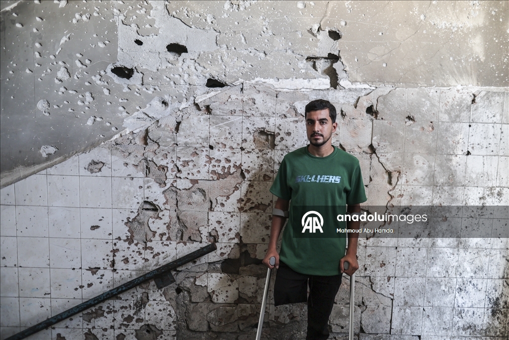 Палестинец Махмуд Саллуут, ставший инвалидом после израильских атак, борется за жизнь