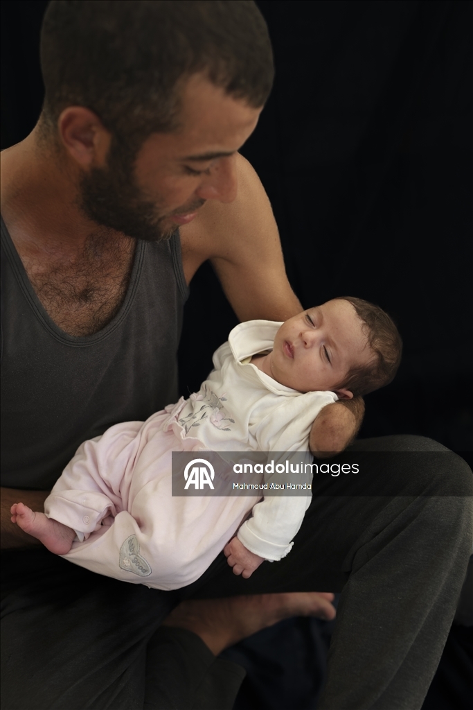 Палестинец Махмуд Саллуут, ставший инвалидом после израильских атак, борется за жизнь