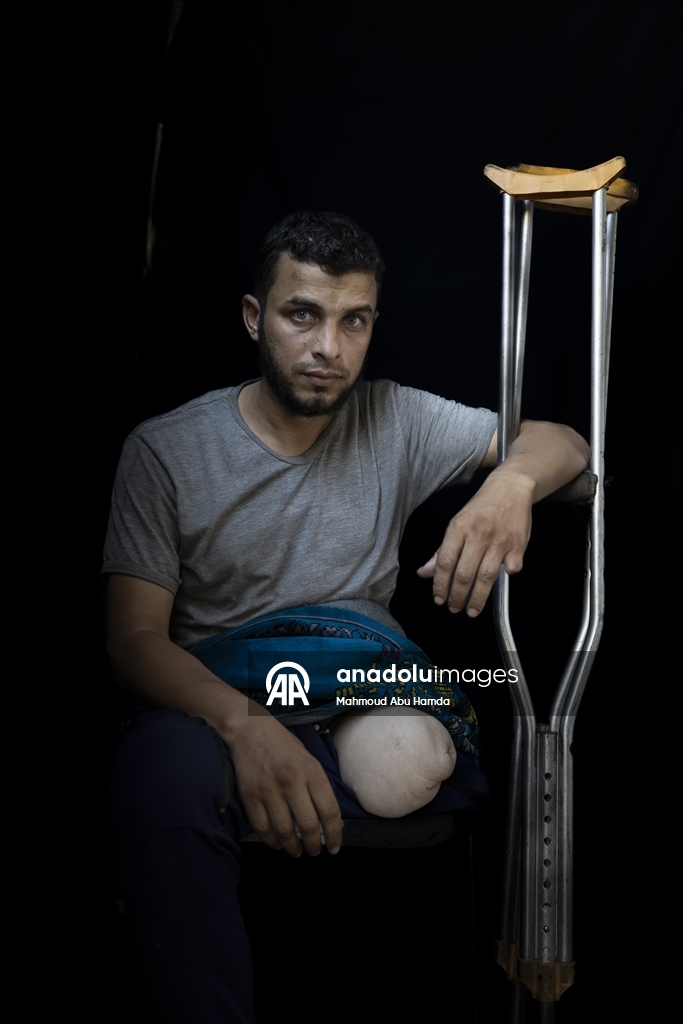 Палестинец Махмуд Саллуут, ставший инвалидом после израильских атак, борется за жизнь