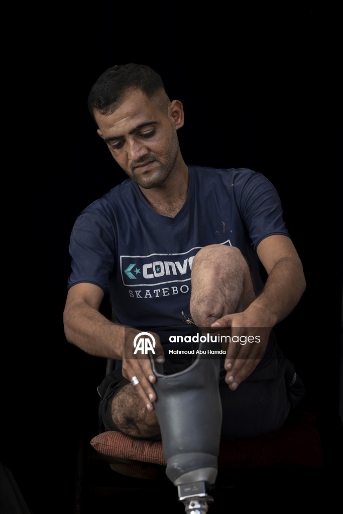 Палестинец Махмуд Саллуут, ставший инвалидом после израильских атак, борется за жизнь