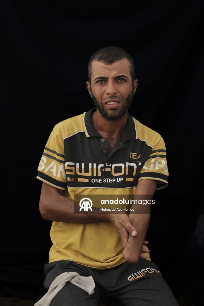 Палестинец Махмуд Саллуут, ставший инвалидом после израильских атак, борется за жизнь