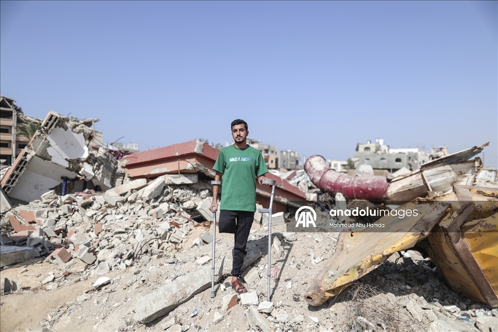 Палестинец Махмуд Саллуут, ставший инвалидом после израильских атак, борется за жизнь