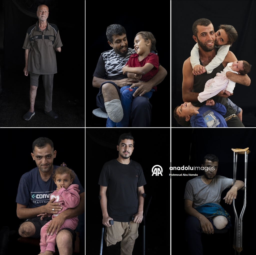 Палестинец Махмуд Саллуут, ставший инвалидом после израильских атак, борется за жизнь