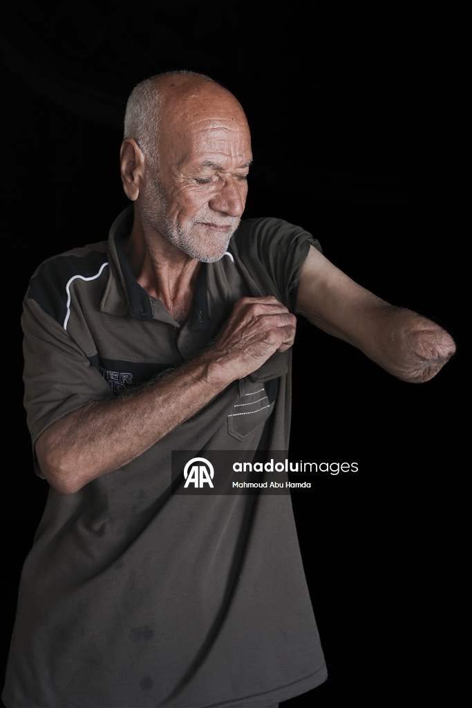 Палестинец Махмуд Саллуут, ставший инвалидом после израильских атак, борется за жизнь