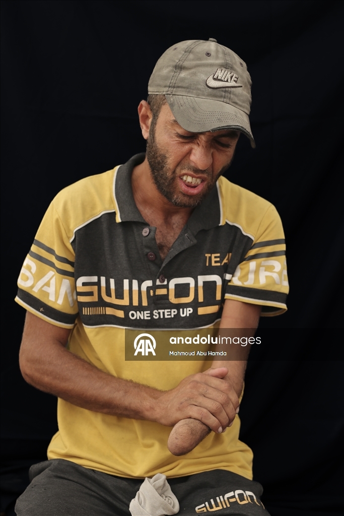 Палестинец Махмуд Саллуут, ставший инвалидом после израильских атак, борется за жизнь