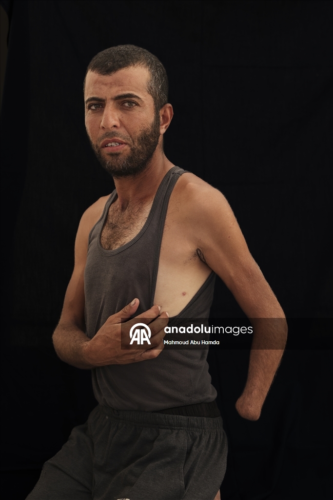 Палестинец Махмуд Саллуут, ставший инвалидом после израильских атак, борется за жизнь