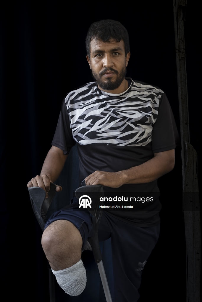 Палестинец Махмуд Саллуут, ставший инвалидом после израильских атак, борется за жизнь