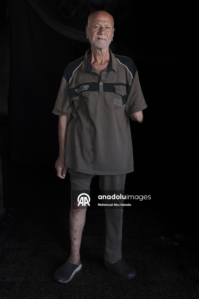 Палестинец Махмуд Саллуут, ставший инвалидом после израильских атак, борется за жизнь