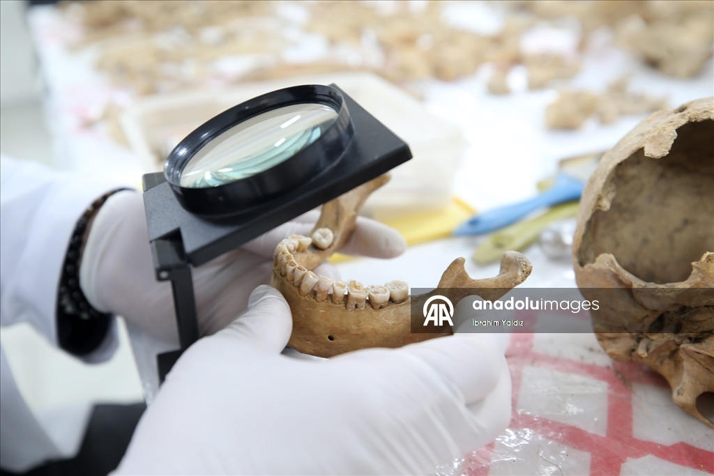 Malazgirt'teki kazılarda çıkarılan insan iskeletlerinin sırrı antropoloji laboratuvarında araştırılıyor